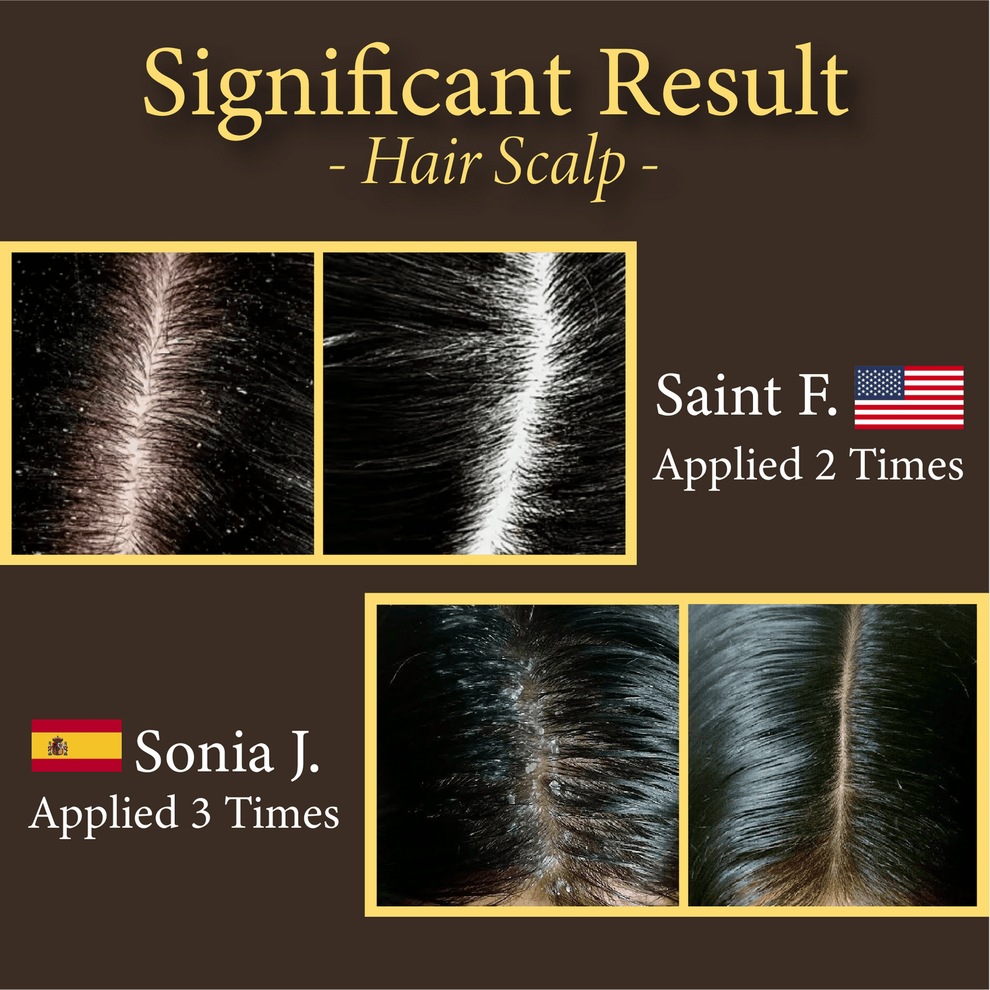 Ginger Scalp Care Shampoo