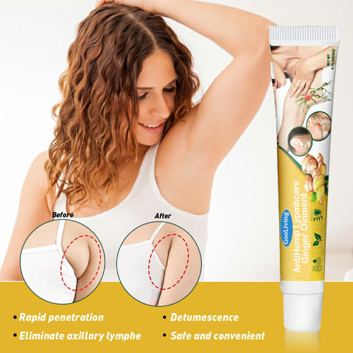 GooLiving AntiHump Lymphcare Ginger Ointment