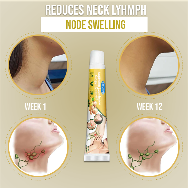 GooLiving AntiHump Lymphcare Ginger Ointment