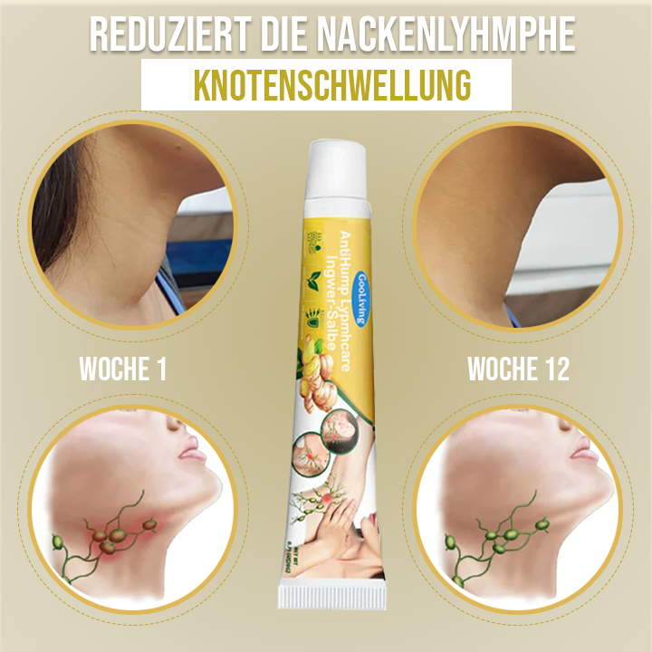 GooLiving AntiHump Lymphcare Ingwer-Salbe