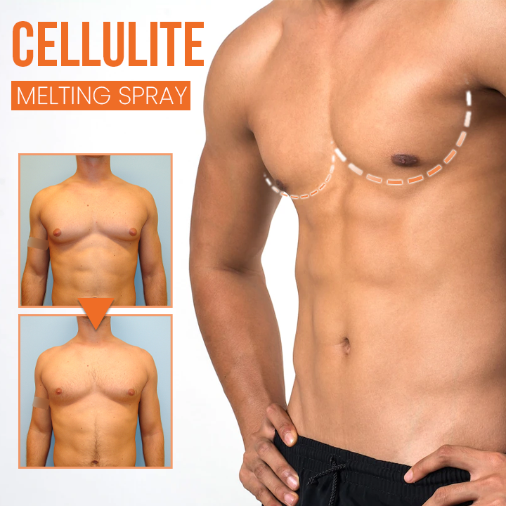 FitPlus™ Anti-Gynecomastia Spray