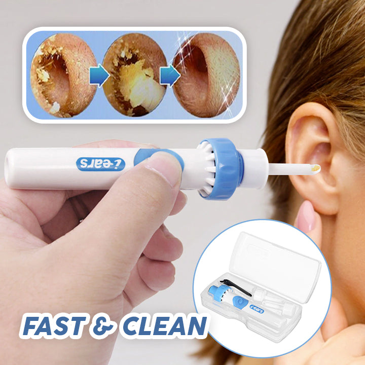 Smart Ear Wax Vacuum Cleaner