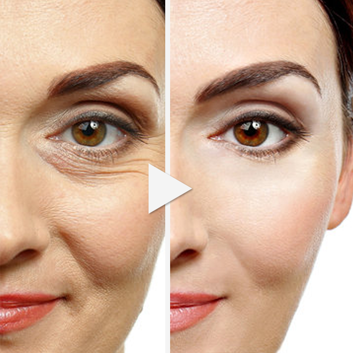 INSTALIFT™ Protein Threading Set