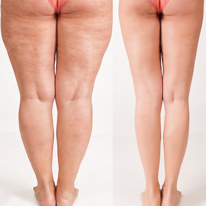 Dermisol™ Instant Firming Cellulite Reducing Spray