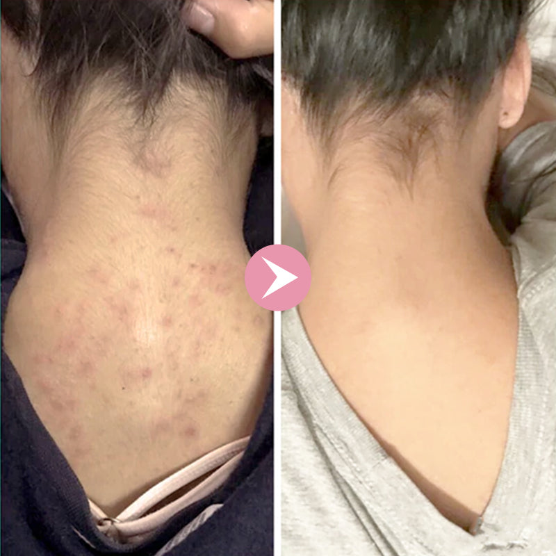 Pure AHA + BHA Treatment Serum