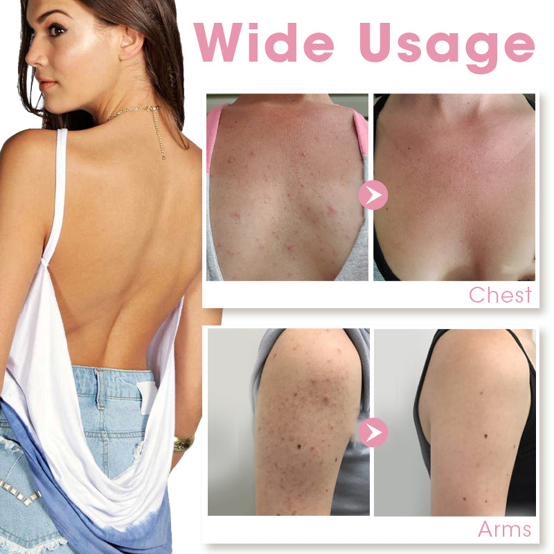 Pure AHA + BHA Treatment Serum