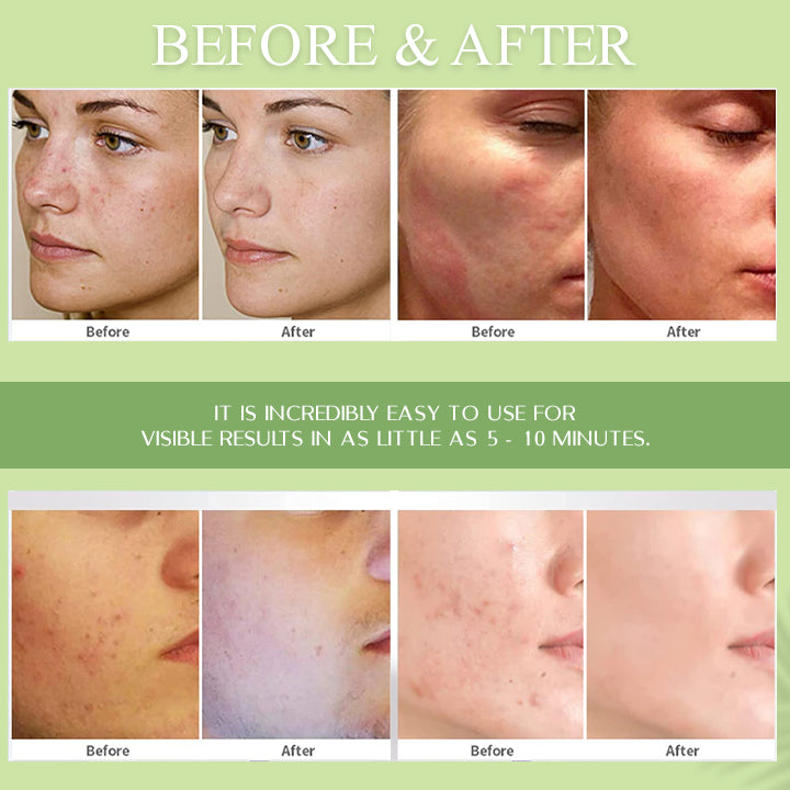 Green Tea Pore Cleansing Mask