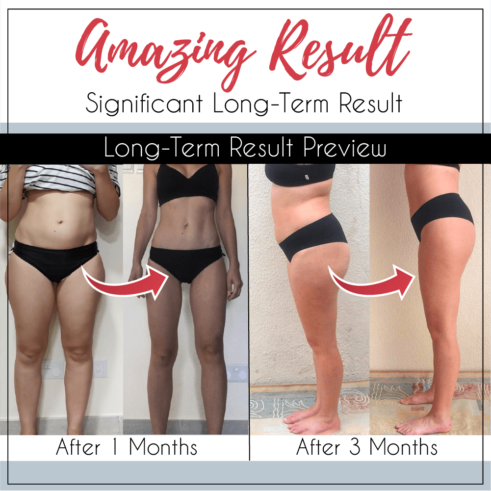 Sleeping Beauty Legs Shaper