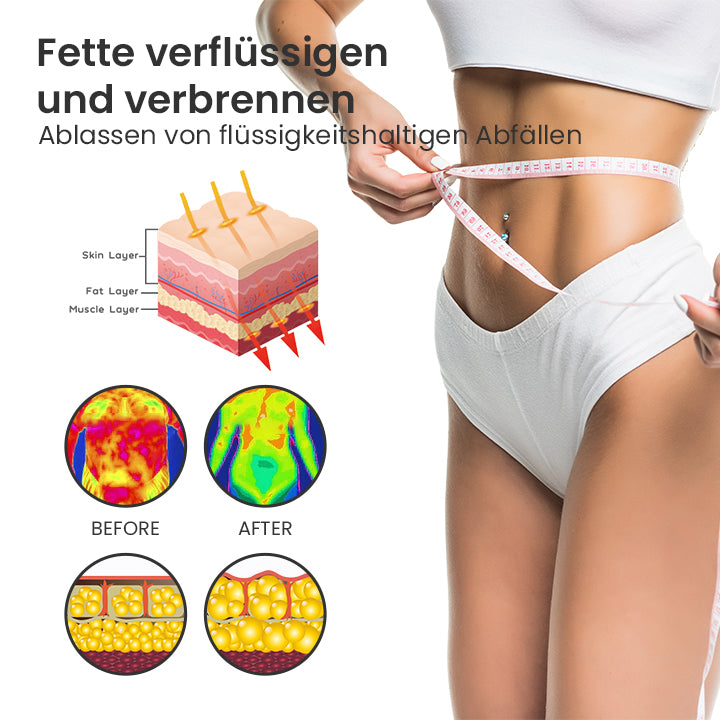 SlimVibe™ Ultraschall-CelluBurn-Armband