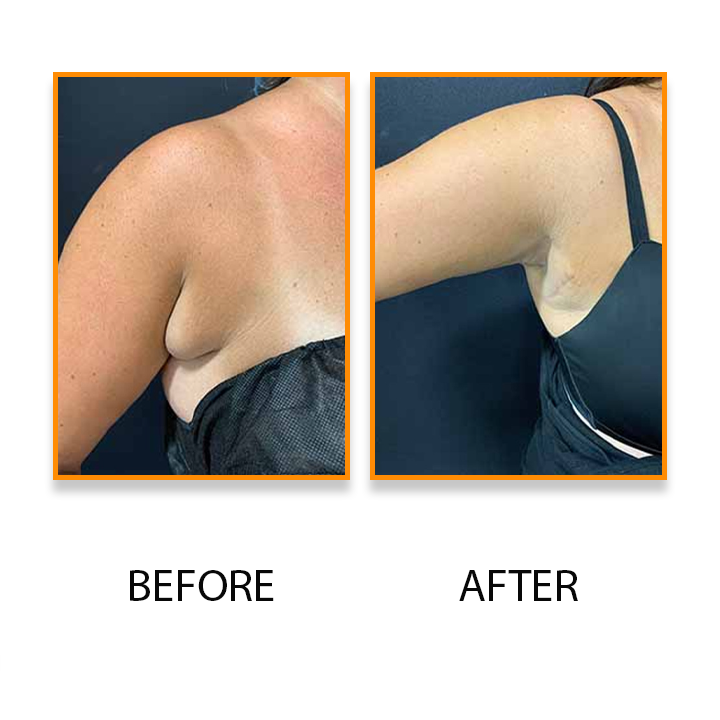 LymphClear™ Anti-Swelling Detox Ointment