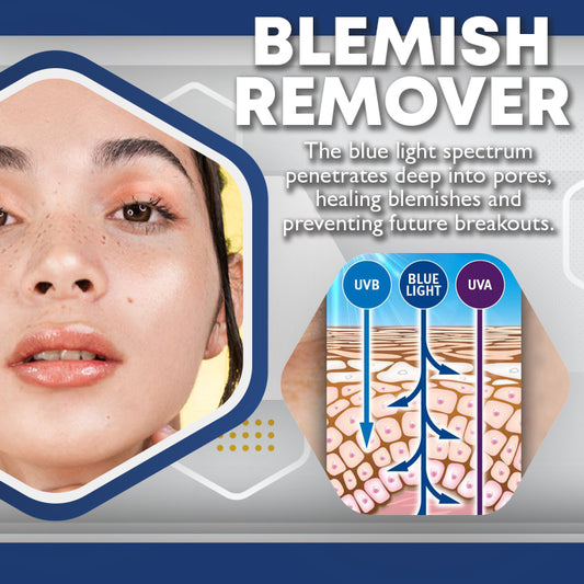 MEDICO™ Blue Light Skin Spot Remover