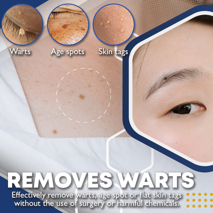 MEDICO™ Blue Light Skin Spot Remover