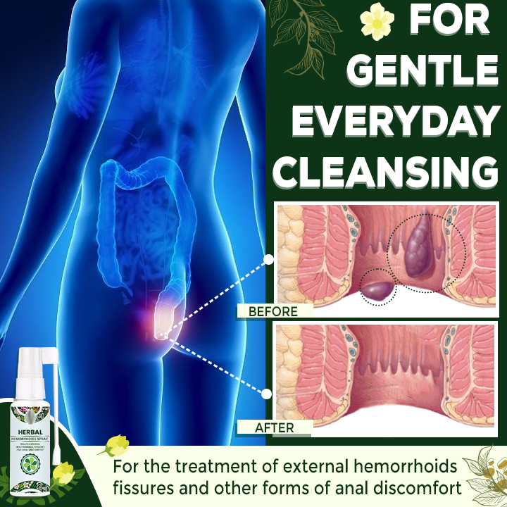 All-Natural Hemorrhoids Relief Spray