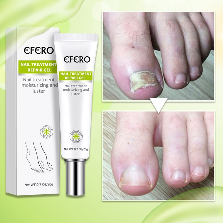 NailPro™ Treatment Repair Gel