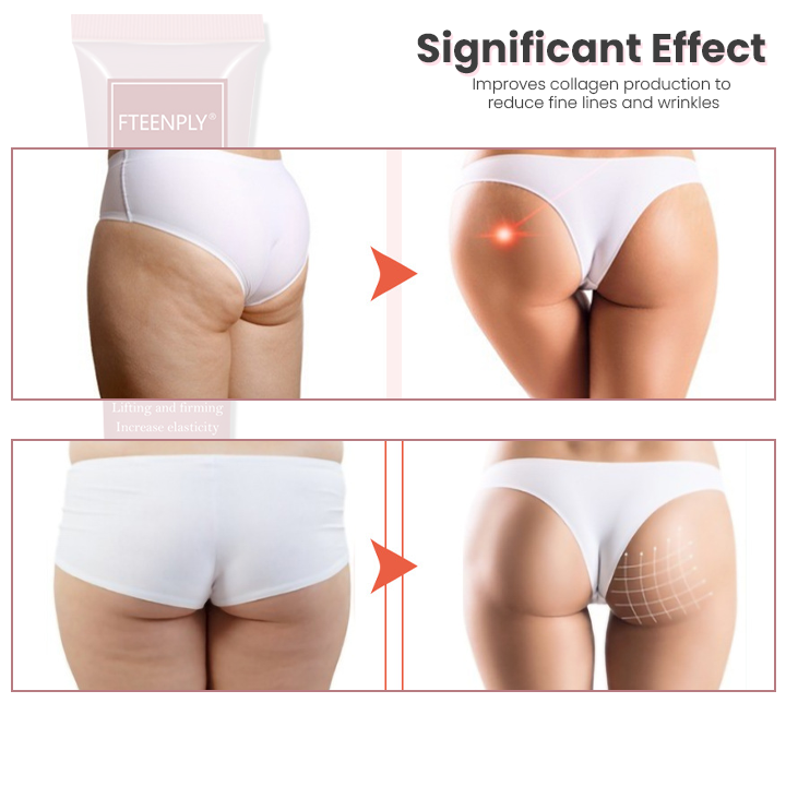 PeachyBum™ Butt Enhancer Cream