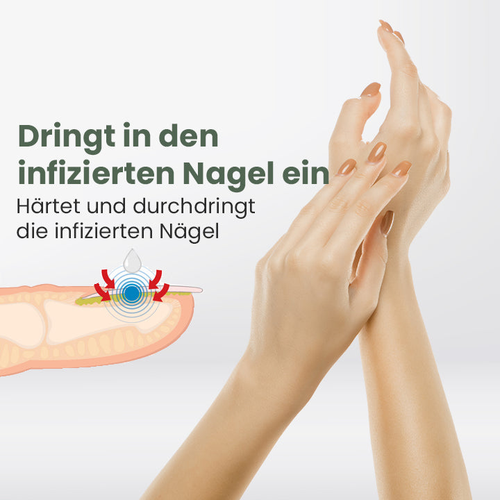 LifeMed Home Verwendung Onychomykose Pilz-Laser-Behandlung
