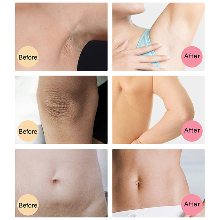 Perfect Skin Brightening Cream