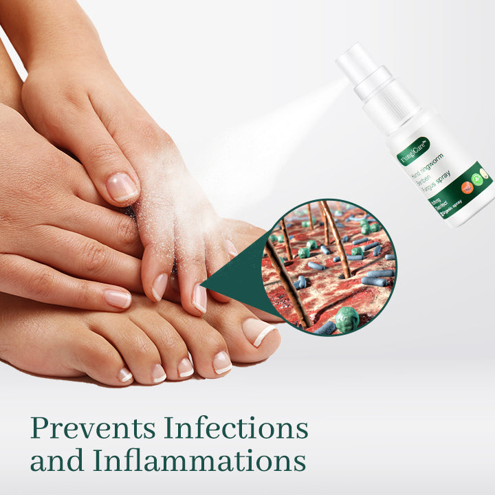 FungiCure™ Anti-Fungal Spray