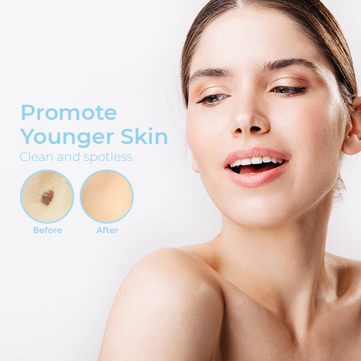 InstaCLEAR™ Spots Removal Pen