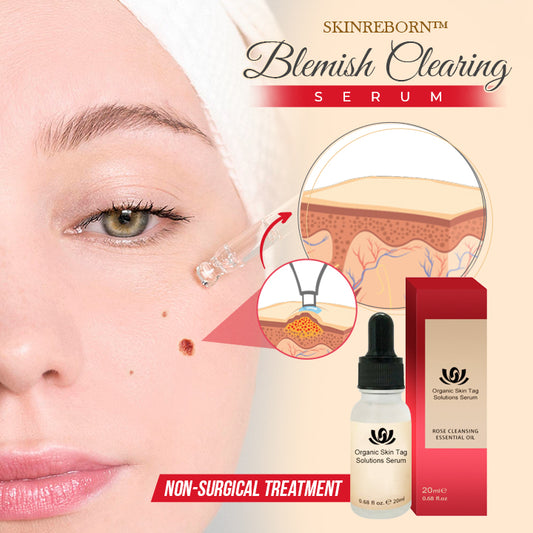 SkinReborn™ Blemish Clearing Serum