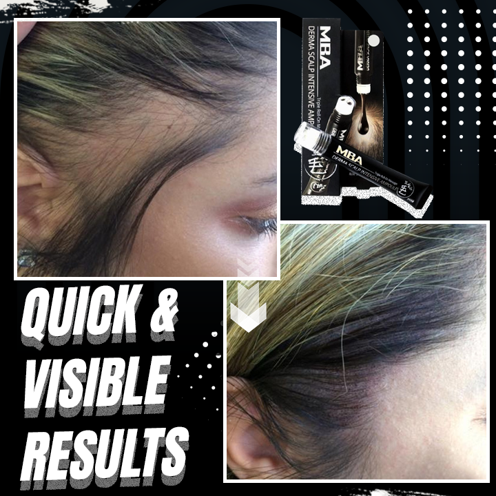 ReGrow™ 2-in-1 Hair Growth Serum Roller