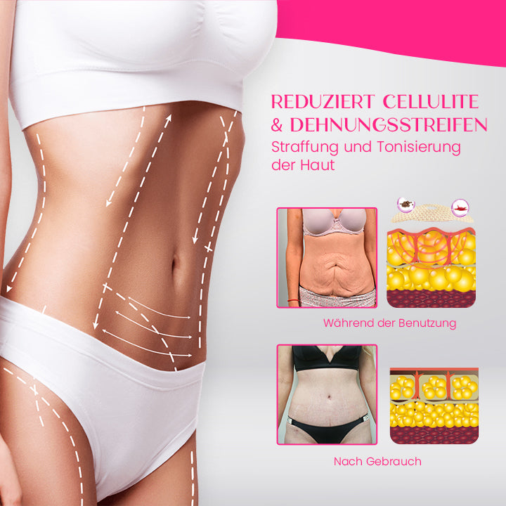 CurvyFit™-Bauchschlankheits-Patch