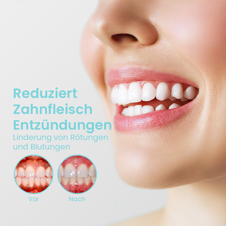 TotalCare™ Teeth Aid Mundspülung