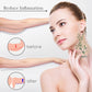 AcuSlim™ Acupressure Slimming Earrings