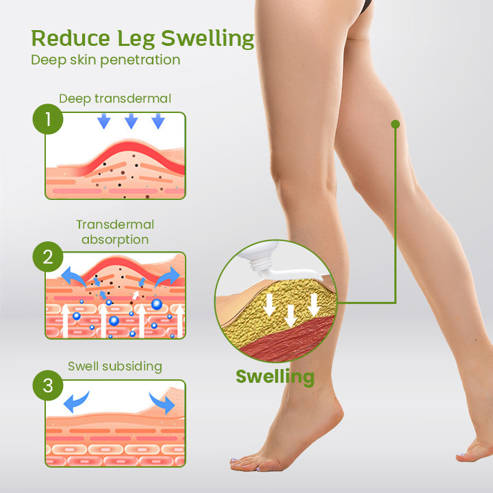 SwellEase™ Leg Relief Anti-Swelling Ointment