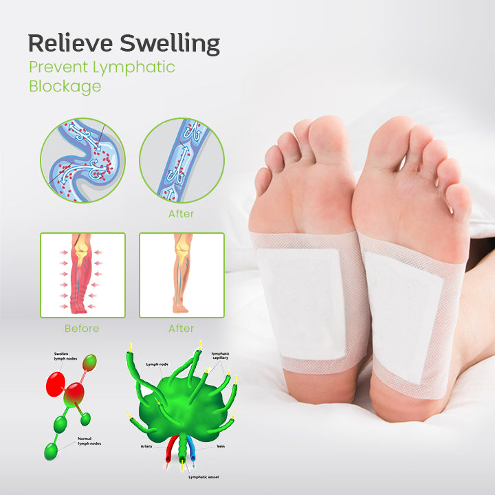VaricoseVeinRx™ Herbal Foot Patch