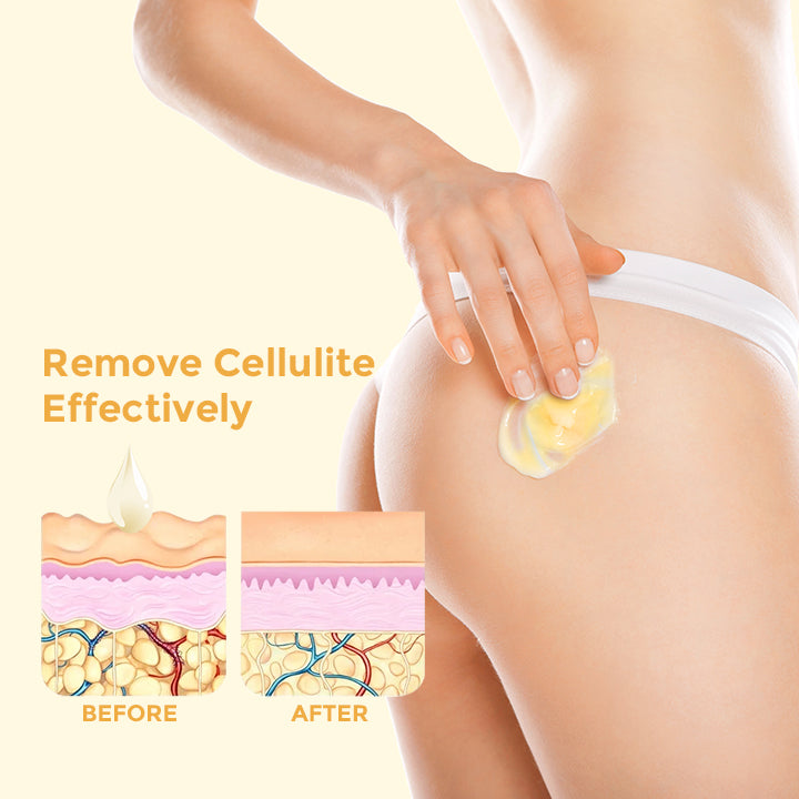 CELLUFIGHT™ Anti-Cellulite Slimming Cream