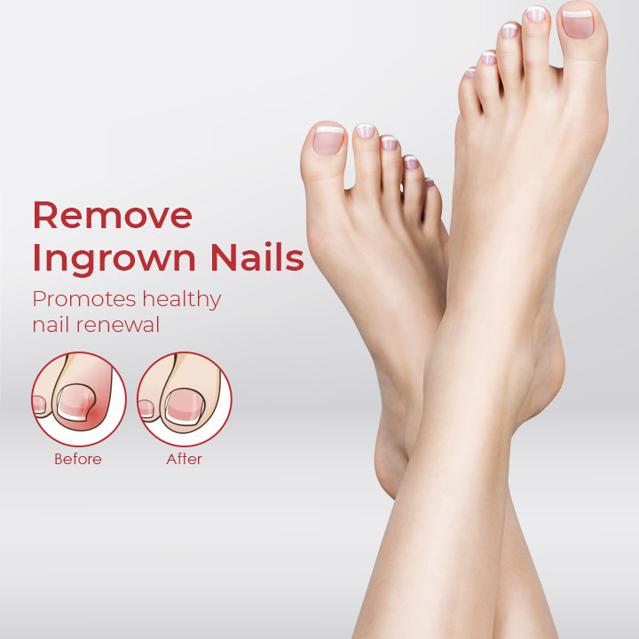 NailPro™ Anti Paronychia Relief Oil