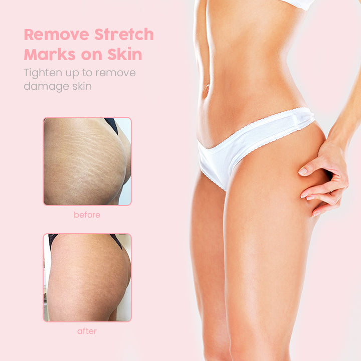 BumBliss™ Booty Perfect Exfoliating Soap