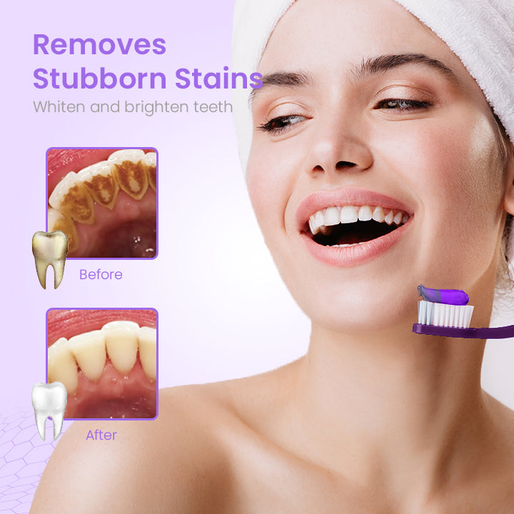 HerbalBrite™ Teeth Whitening Mousse