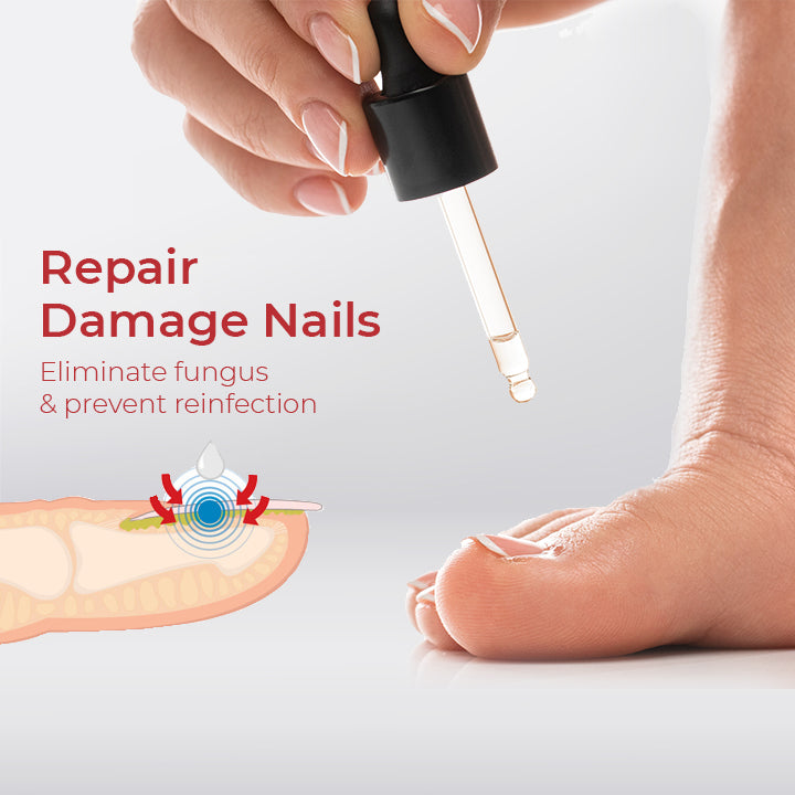NailPro™ Anti Paronychia Relief Oil