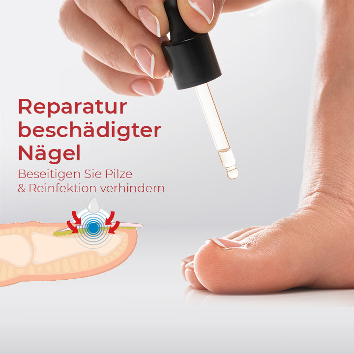 NailPro™ Anti Paronychia Entlastungsöl