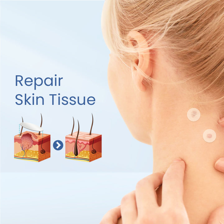 Skin Tag Remover Patch
