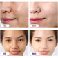 RetinolPro™ Age Rewind Gesichtsserum