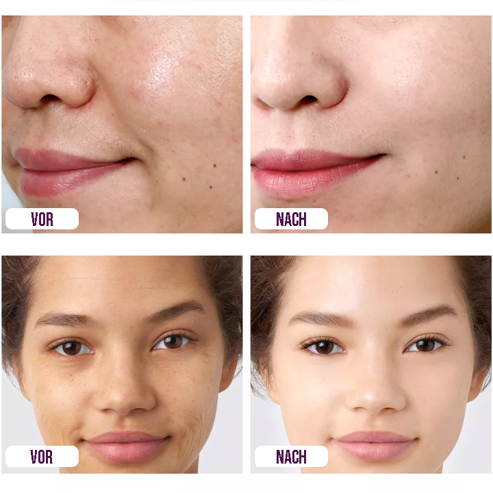 RetinolPro™ Age Rewind Gesichtsserum