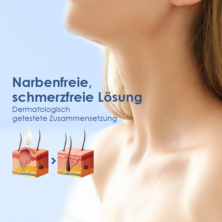 WartsOff Creme zur sofortigen Entfernung von Hautunreinheiten