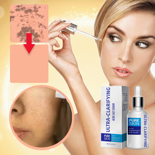Ultra-Clarifying Acne Out Serum