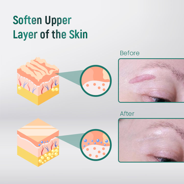 ScarXpert™ Advanced Scar Removal Gel