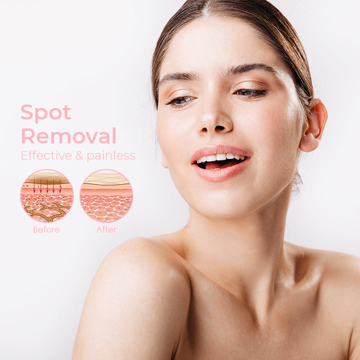 SpotFree Electric Beauty Pen