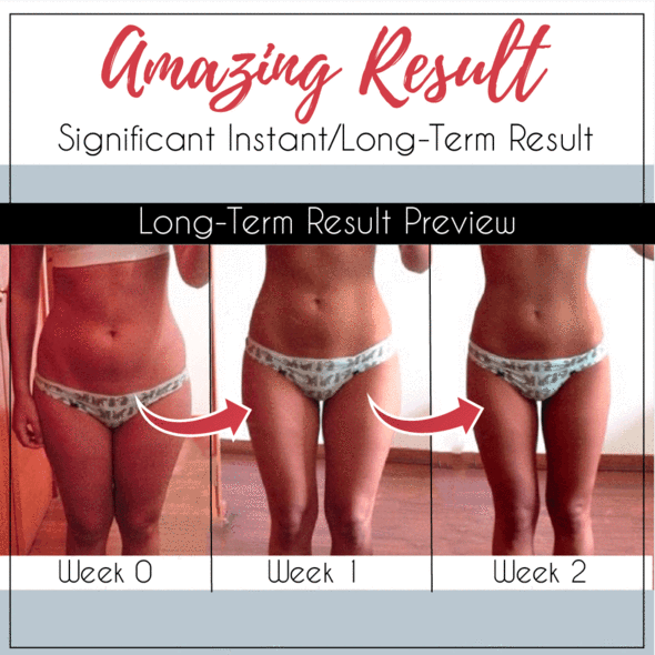 SHAPE™ Pelvis Correcting Thigh Slimmer
