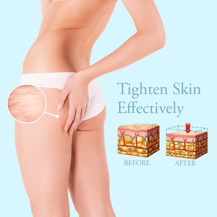 ProFirm Skin Tightening Spray