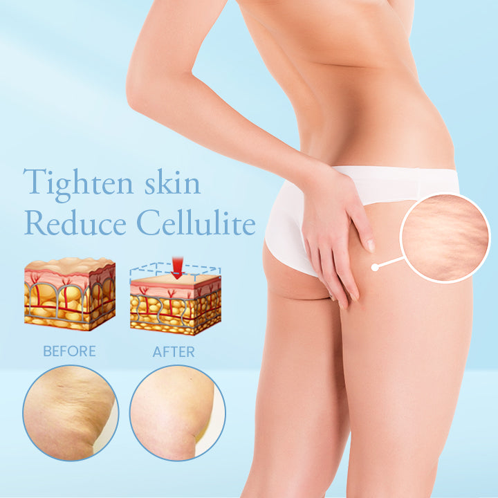 ProFirm Skin Tightening Spray