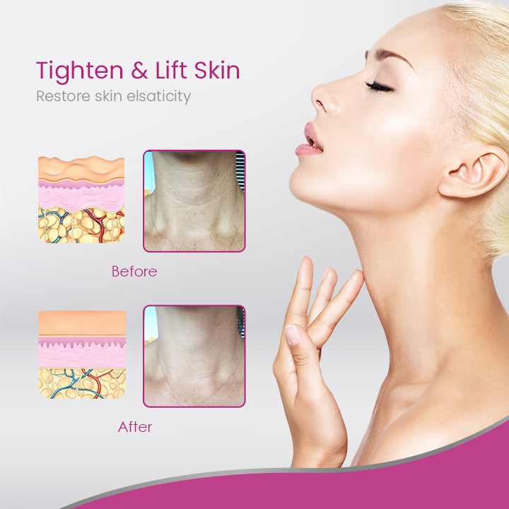 CollagenLUXE™ Hydrolyzed Collagen Neck Cream