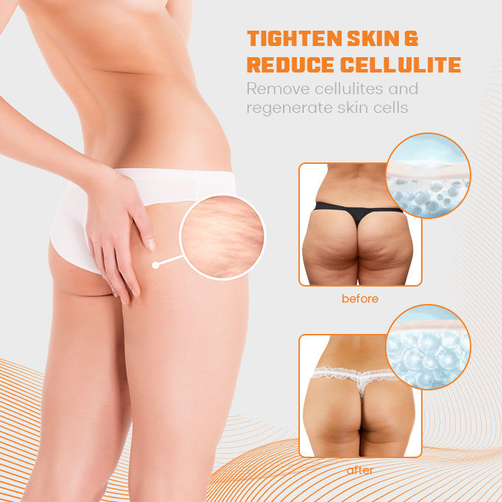 FitHips™ Microcurrent ButtLift Trainer