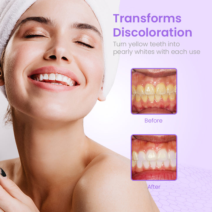 HerbalBrite™ Teeth Whitening Mousse