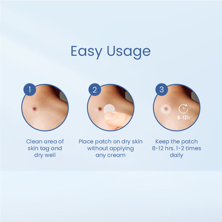 Skin Tag Remover Patch
